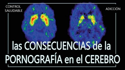 Las Consecuencias De La Pornograf A En El Cerebro Youtube