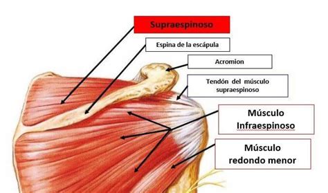 Tendinitis Del Supraespinoso Y Dolor De Hombro Clínica Arias