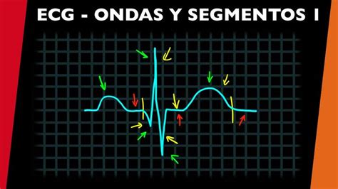 Como Interpretar O Ecg Aprenda A Ler O Eletrocardiograma 49 Off