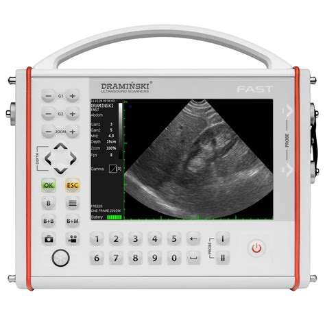 Ecógrafo portátil FAST DRAMINSKI S A para ecografía ginecológica