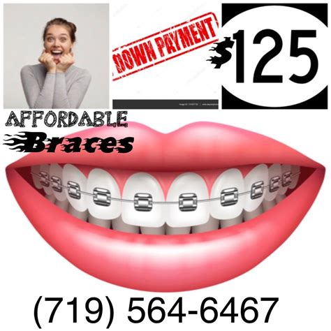 Braces For Less At Young At Heart Orthodontics Call Our Office At