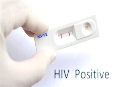 Unprotected Sex Seventeen Lakh People Contracted HIV India Last Ten Years India Hindi News