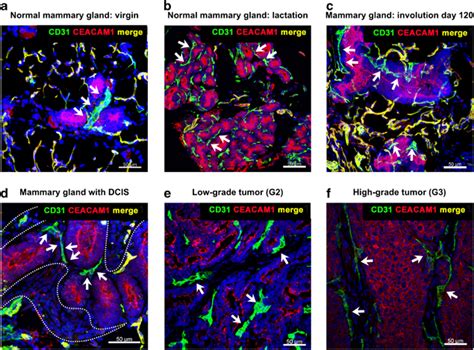 Representative Analysis Of Cd31 And Ceacam1 Co Expression In The Normal Download Scientific