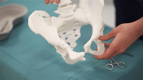 Eurostars For 3d Printing Innovation In Orthopedics Mriguidance