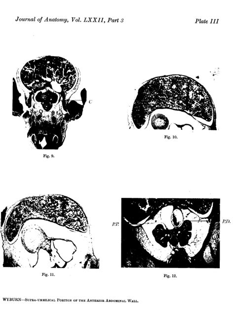 development   supra umbilical portion   anterior
