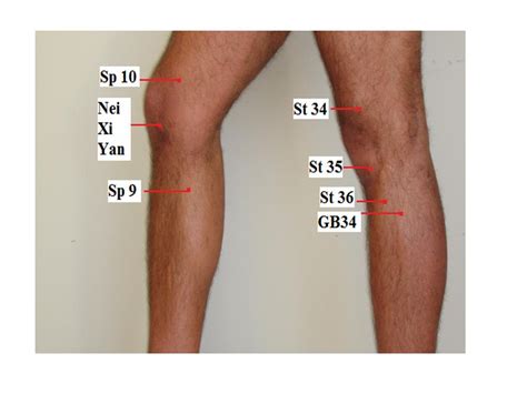 28 Acupuncture And Knee Pain And Osteoarthritis Jun Xu M D 203