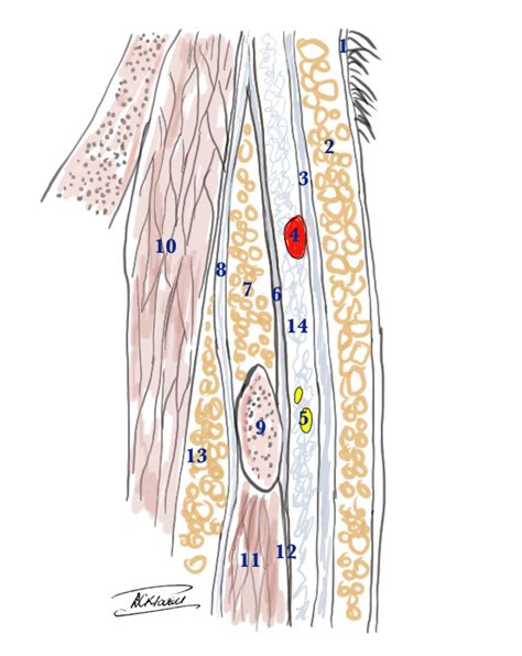 Figure Superficial Temporal Artery And The StatPearls NCBI