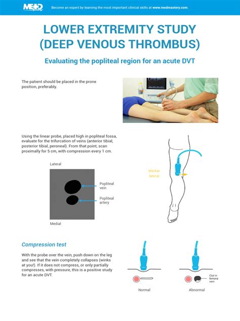 Evaluating The Popliteal Region For An Acute Dvt Pdf