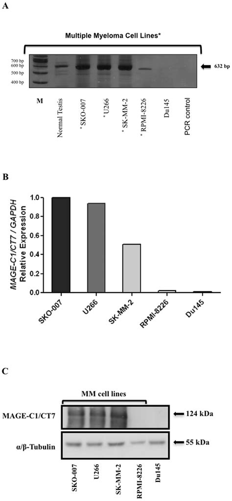 MAGE C1 CT7 Expression In Multiple Myeloma MM Cell Lines A RT PCR