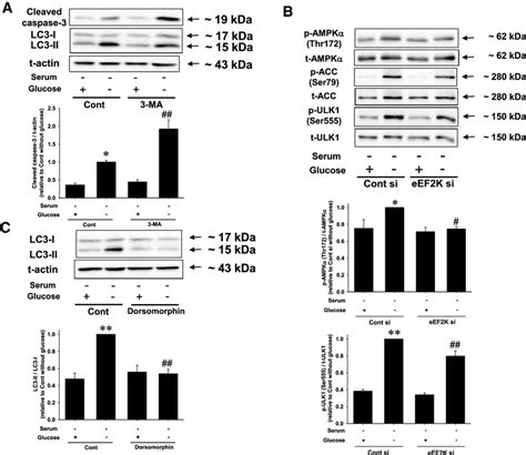 Eef K Eef Axis Plays An Inhibitory Role Against Gd Induced Apoptosis