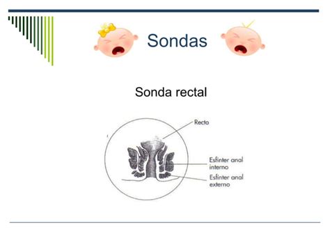 Sondas En Pacientes Pediatricos Ppt