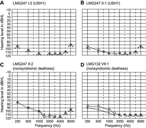 Pure Tone Air Conduction Thresholds For The Right Ear O And Left Ear Download Scientific