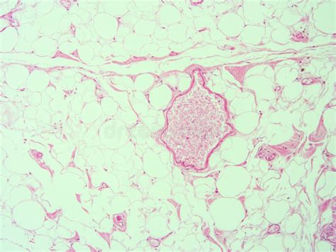 Histology Of Human Gallbladder Tissue Stock Photo Image Of