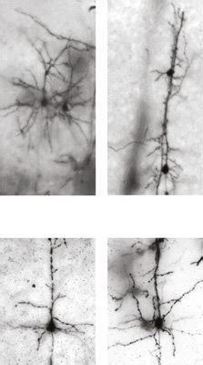 NOMA GAP Regulates Dendritic Complexity In Vivo A C Loss Of NOMA GAP