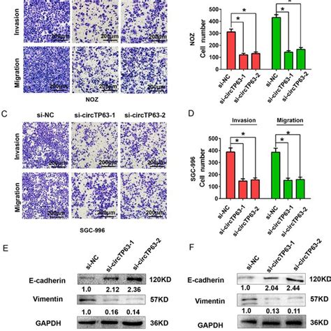 Circtp Knockdown Suppressed Cell Migration Invasion And Cell Emt