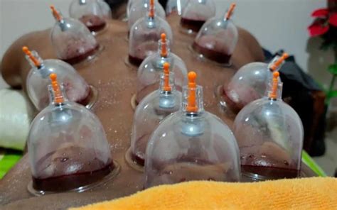 Hijama Treatment Plan To Welcome Ramadan Tangail Hijama Center