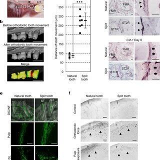 Transplantation Of A Split Tooth Germ A Schematic Representation