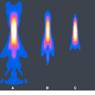 PDF Comparison Of Widefield Deconvolution And Confocal Microscopy For