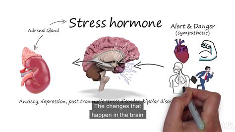 Stress Affects Your Brain And Health Youtube