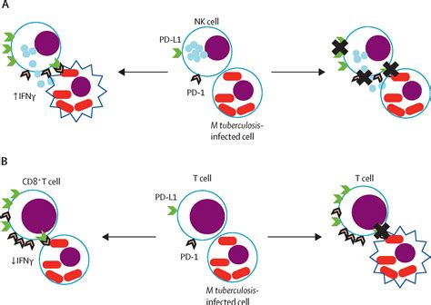 Immune Checkpoint Inhibitors And Tuberculosis An Old Disease In A New