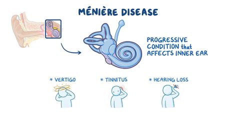 Meniere disease: Nursing - Osmosis Video Library