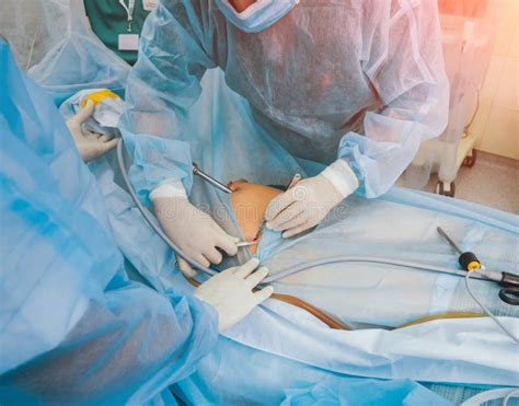 Process Of Gynecological Surgery Operation Using Laparoscopic Equipment