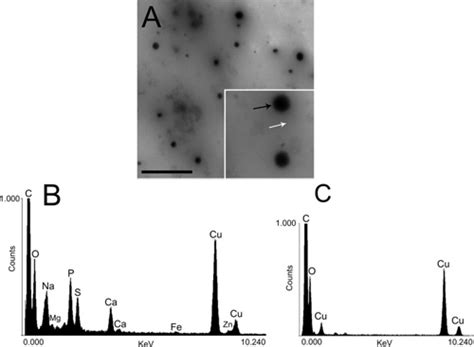 Figure S1 Electron Microscopy And X Ray Microanalysis Of The Dense