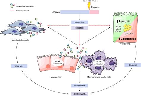 Gasdermin D Plays A Key Role As A Pyroptosis Executor Of Non Alcoholic