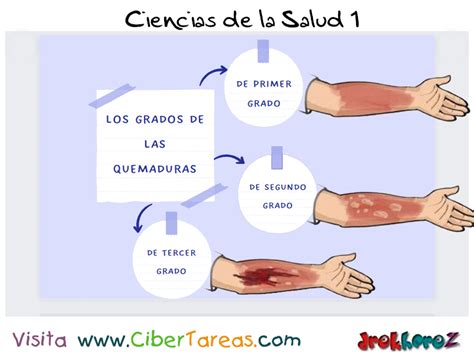 Los Grados De Las Quemaduras Y La Regla Del Nueve Ciencias De La