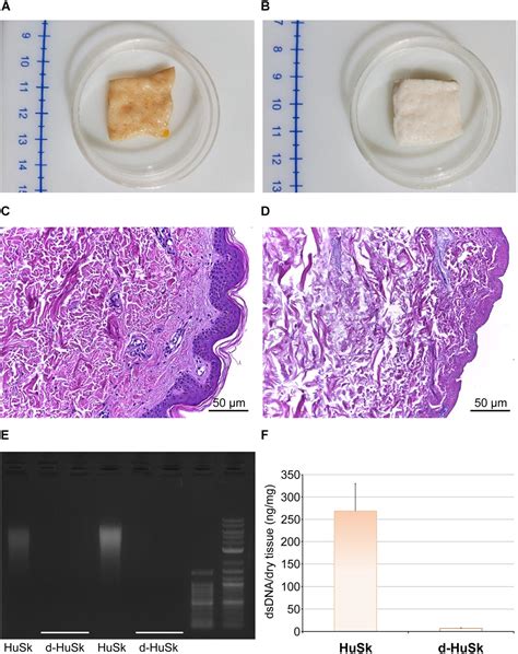 Frontiers Decellularized Human Dermal Matrix As A Biological Scaffold