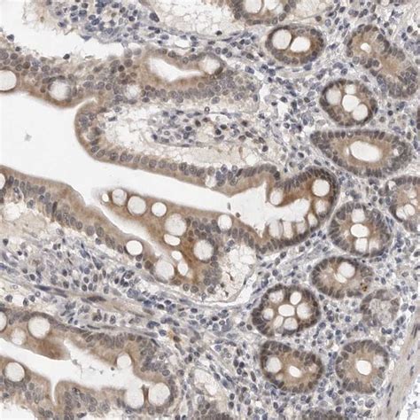 Rabbit Polyclonal Anti Alpk2 Antibody Buy For Research Highly