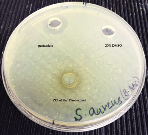 Zone Of Inhibition In Staphylococcus Aureus The Image Displays The