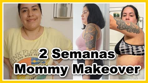 Semanas Despues De Mi Mommy Makeover Update De Mi Recuperacion Fotos