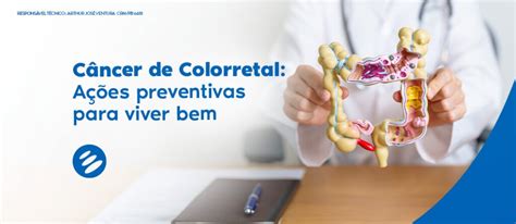 Câncer De Colorretal Como Prevenir Imago Diagnóstico Por Imagem