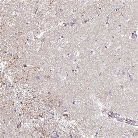 Ip K Polyclonal Antibody Invitrogen L Unconjugated Fisher