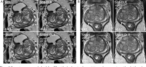 Figure 1 From Deep Learning Based Reconstruction Of T2 Weighted