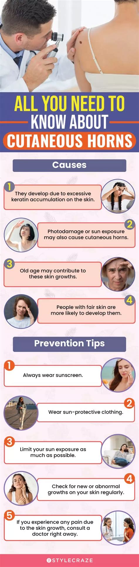 Cutaneous Horn Causes Diagnosis Risk Factors And Treatment