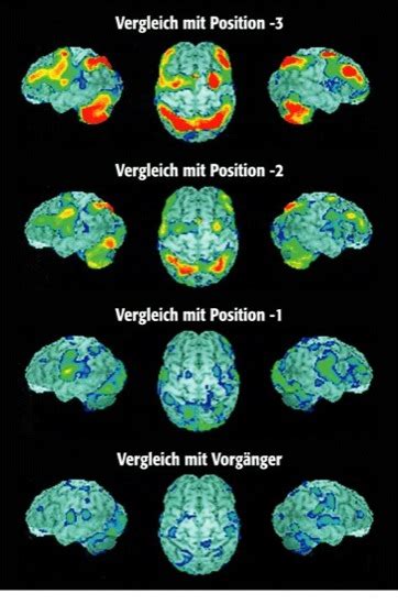 Bildgebung In Der Neurowissenschaft Lexikon Der Neurowissenschaft