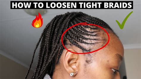 How To Loosen Tight Braids Fast Youtube