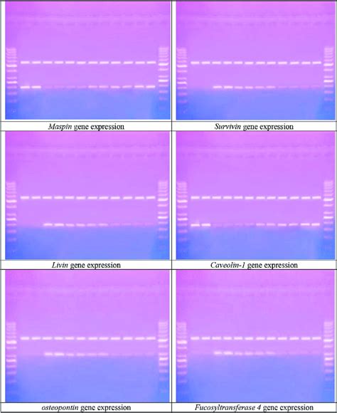 Ethidium Bromide Stained Agarose Gel Electrophoresis Of Maspin