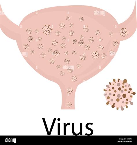 Urinary Tract Infection Bladder Full Of Virus Infection Vector