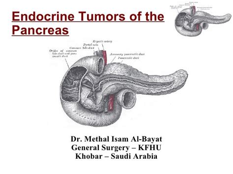 Cancer as related to Islet Cell Carcinoma (Endocrine Pancreas) - Pictures