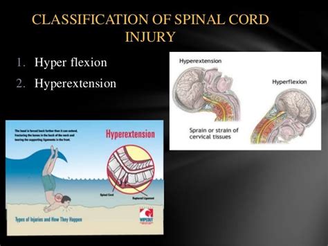 Traumatic Head And Spinal Cord Injury