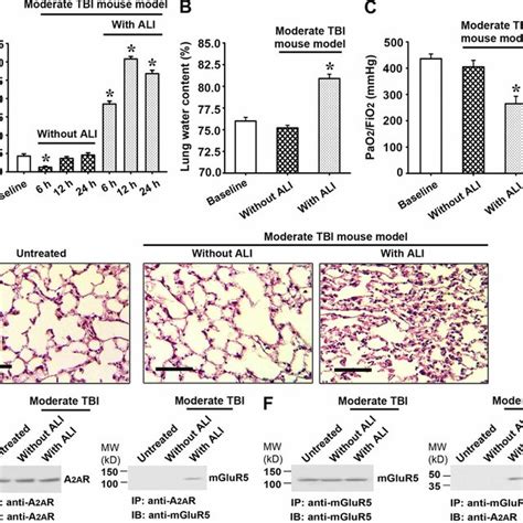 Plasma Glutamate Level Lung Injury Parameters And Wbc A Armglur