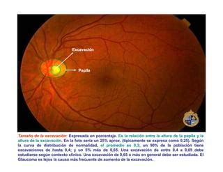 Fondo De Ojo PPT