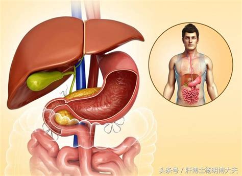 怎樣才能早期發現脂肪肝？ 每日頭條