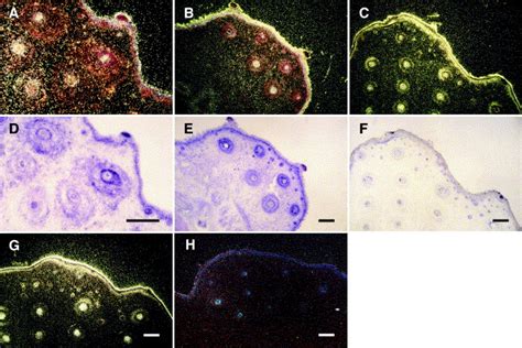 Developmental expression of mafB messenger ribonucleic acids in rat skin by in situ ...