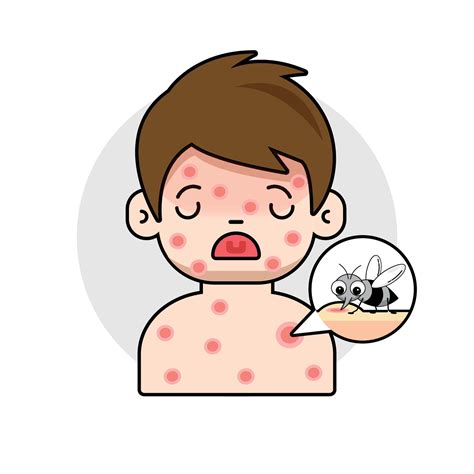 The child has red rashes on his body. Due to being bitten by a mosquito ...