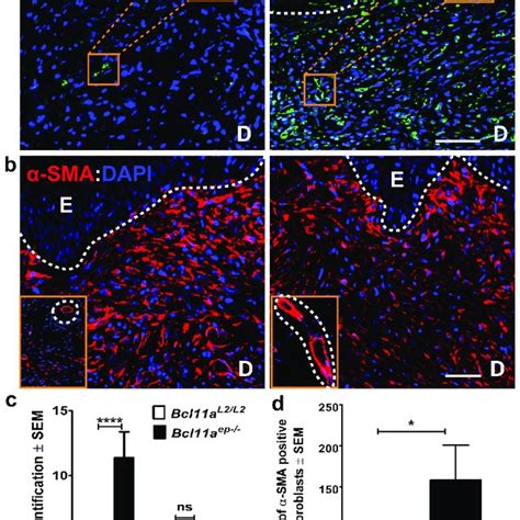 Cell Autonomous Role Of Epidermal Specific Bcl11a Ablation In Promoting