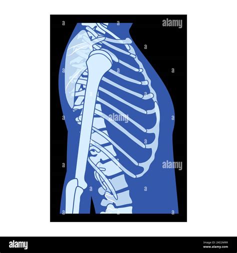 Caja torácica de rayos X y manos Esqueleto Huesos del cuerpo humano